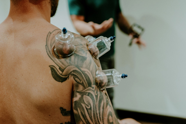 Cupping therapy applied around a patient’s shoulder