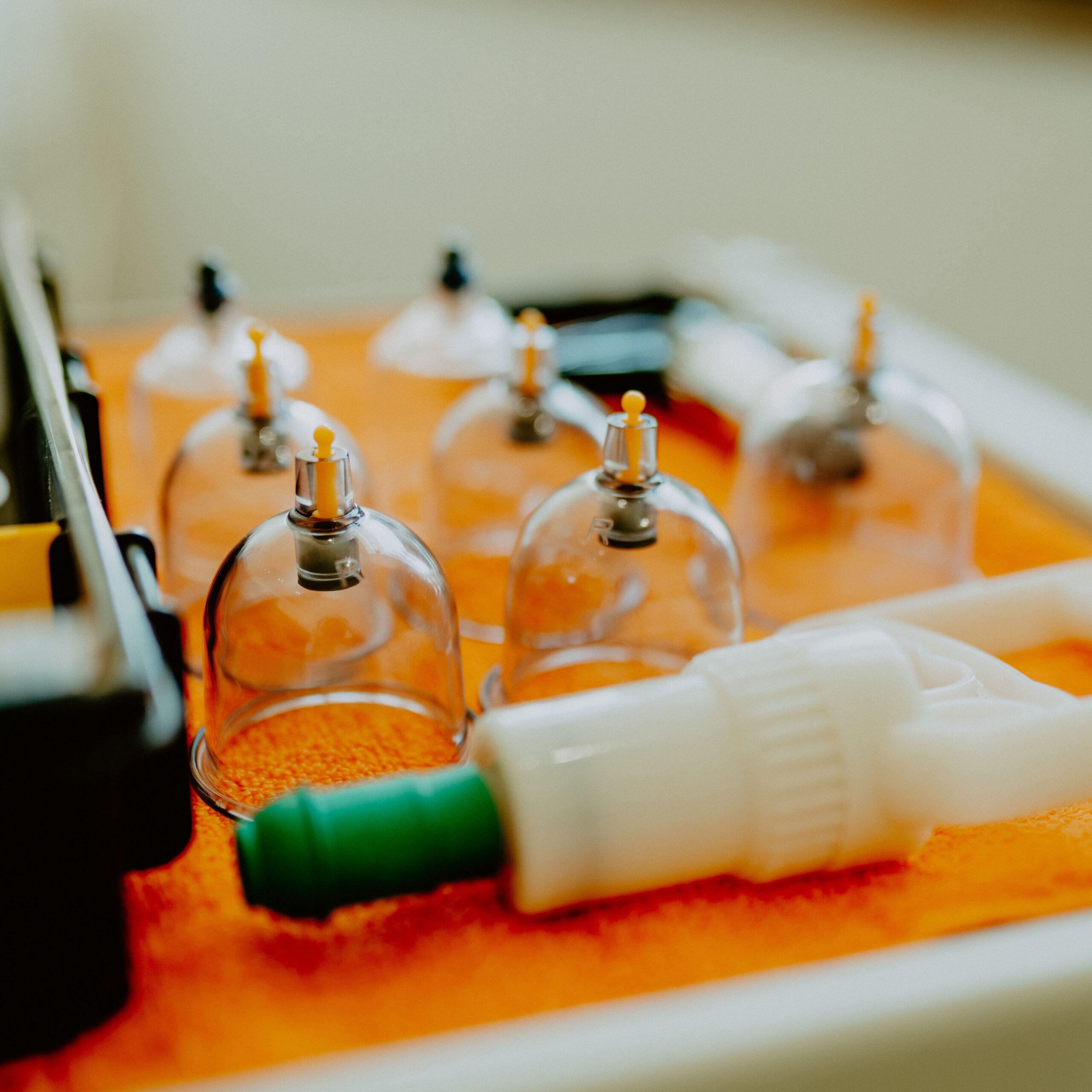 Stationary cupping therapy at Windy Ridge Chiropractic